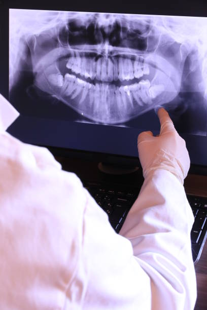 Best Emergency Root Canal Treatment in Freeport, IL